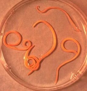 The parasites of man ascaride