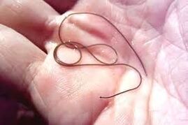 Parasite in his palm