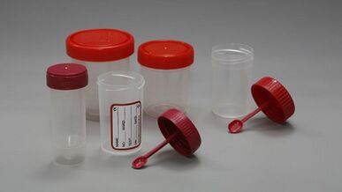 How to Prepare to Test Parasites