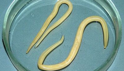 How to perform ascariasis tests correctly